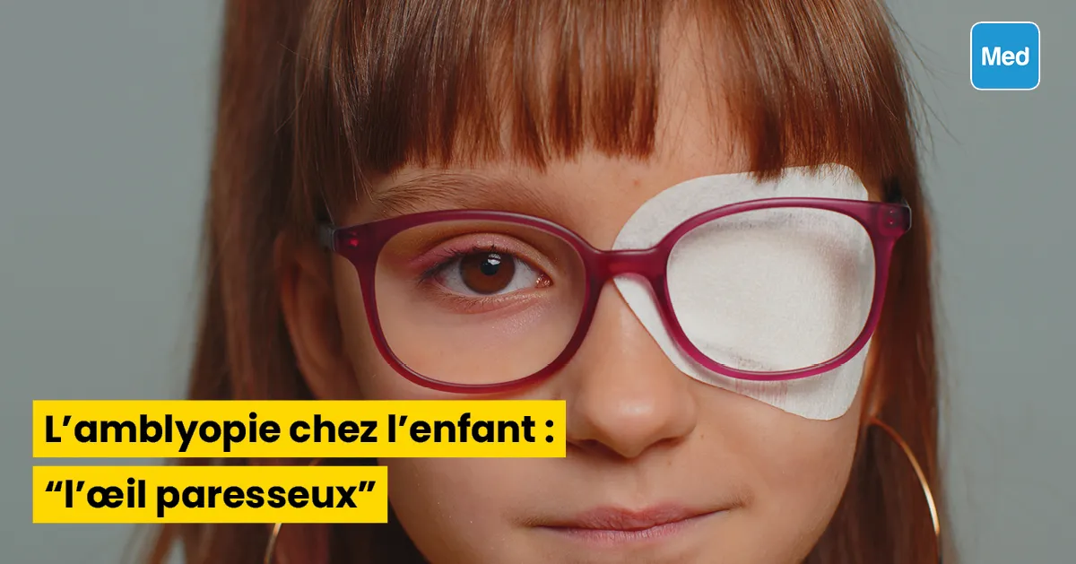 L'amblyopie chez l'enfant : l'œil paresseux